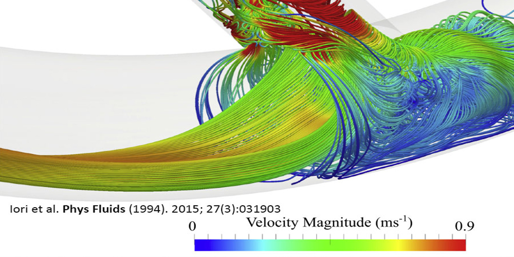 Iori et al. Phys Fluids (1994) 2015;27(3):031903