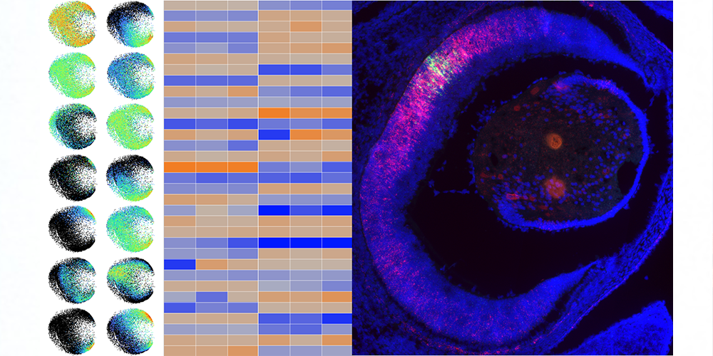 De gauche à droite: nuages de points obtenus par séquençage de cellules uniques de rétines embryonnaires, permettant de distinguer les différentes populations de cellules rétiniennes et d’analyser l’expression des gènes impliqués dans leur développement. 